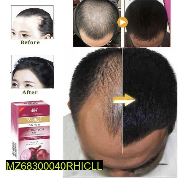 Anti hair loss onion oil 150 ml t4trendz