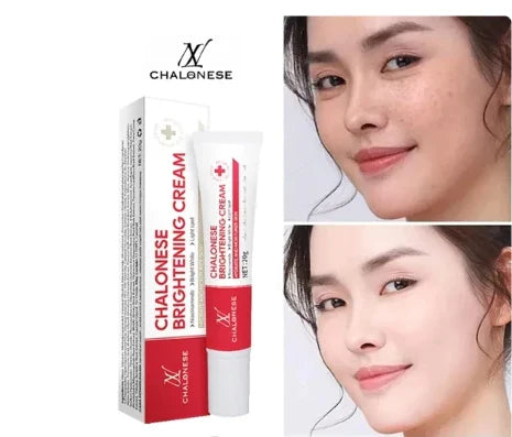 Chalonese Brightening Cream – Buy 1 Get 1 Free