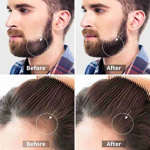HAIR DERMA ROLLER